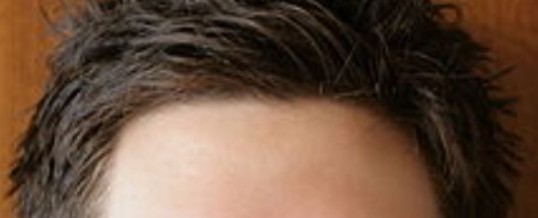 forehead